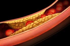 O colesterol dos alimentos aumenta o risco cardiovascular. Mito ou verdade?